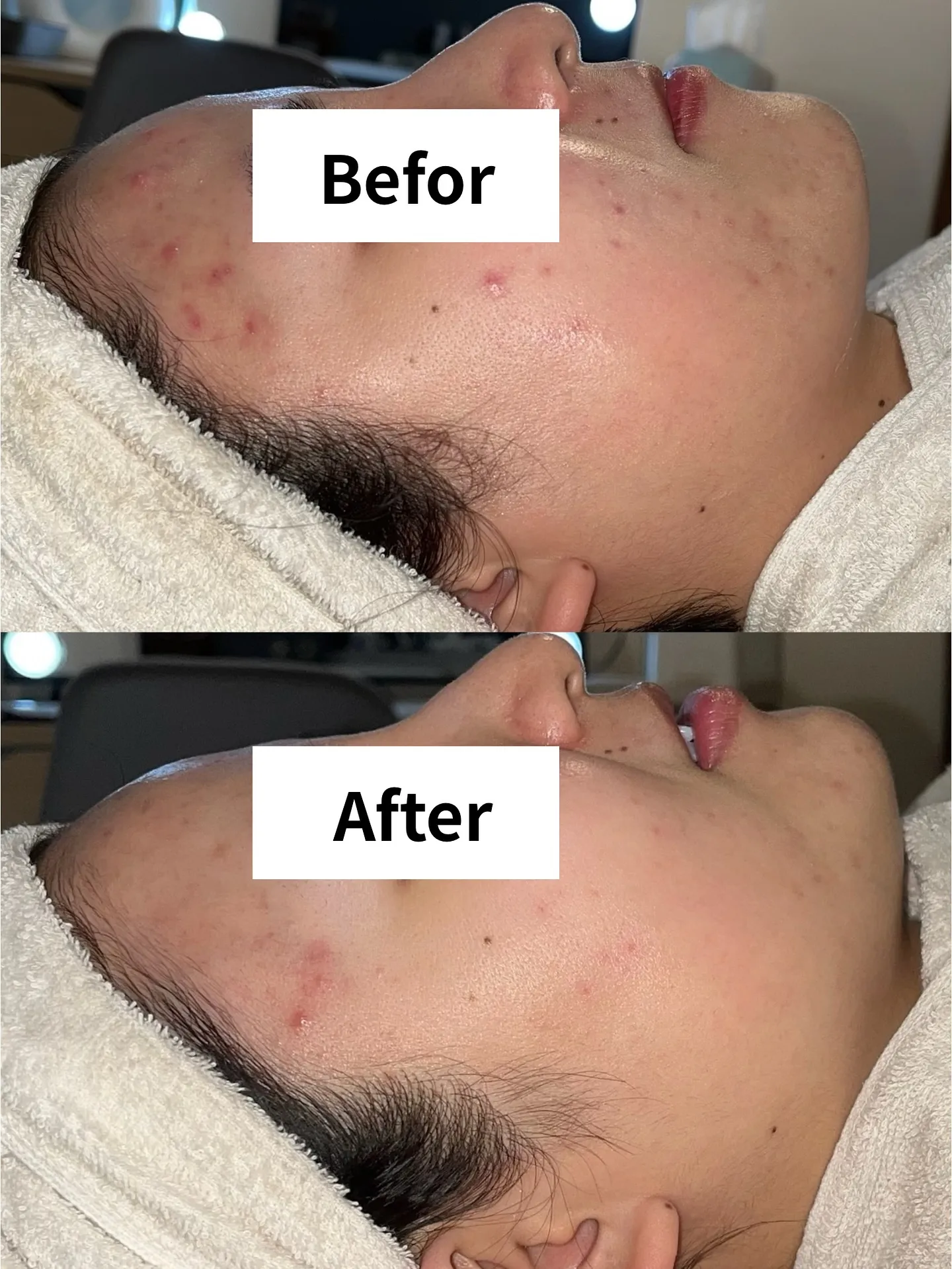 お客様BeforeAfter✨