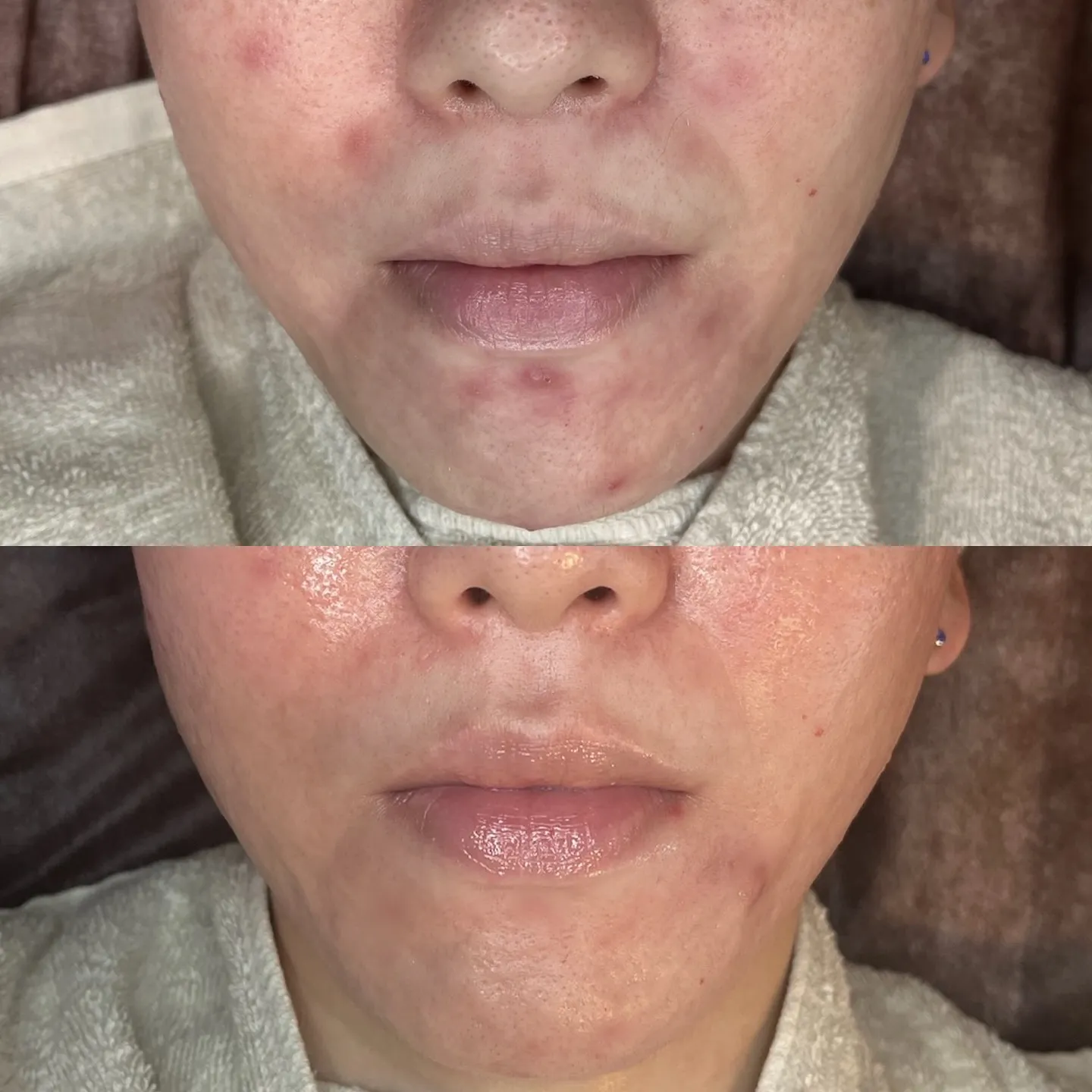 お客様BeforeAfter✨