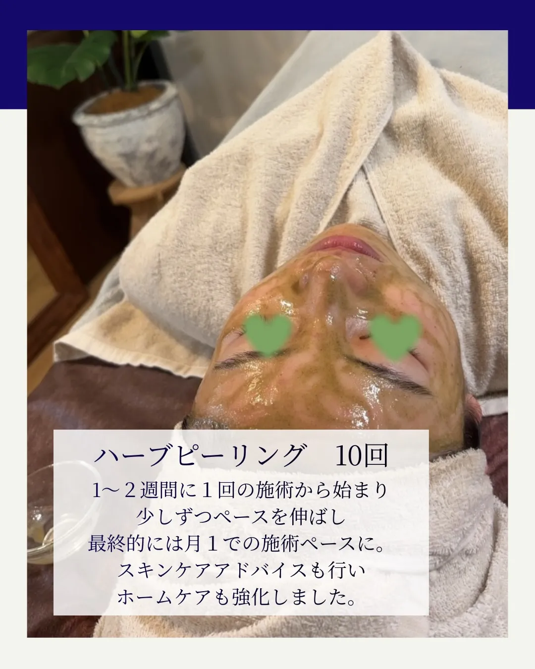 気がついたらニキビが消えていた…