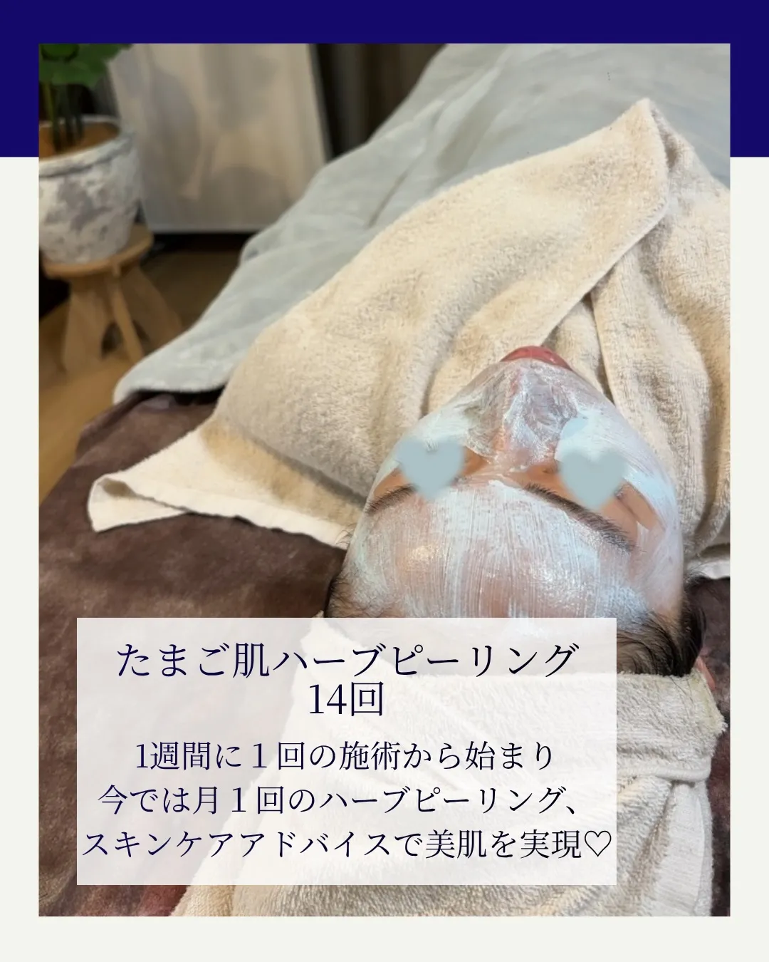 学生時代からニキビで悩むお客様BeforeAfter🪞