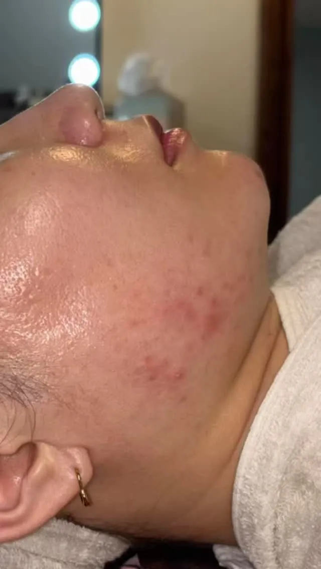 お客様BeforAfter🪞✨